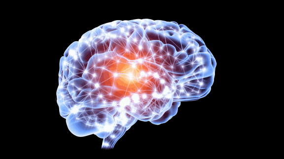 Schlaganfall – das komplexe Gehirn